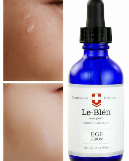 [Le Blen] EGF (Epidermal Growth Factor) Serum ( 1oz)